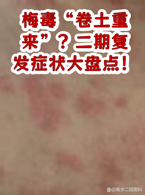 容易忽略的传染和复发问题