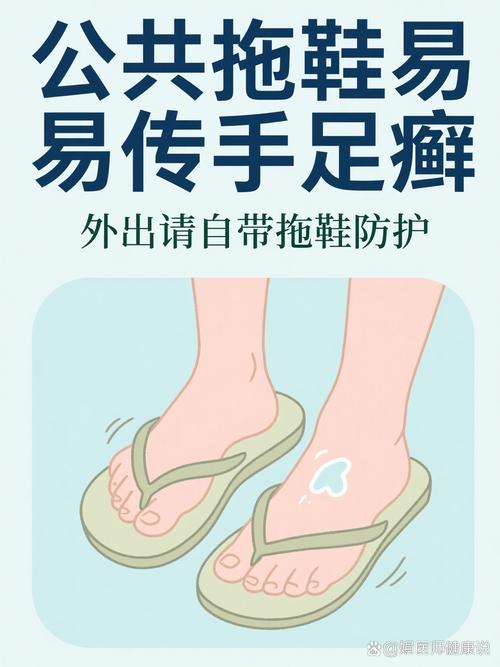 家庭公用拖鞋足部病菌传播示意图