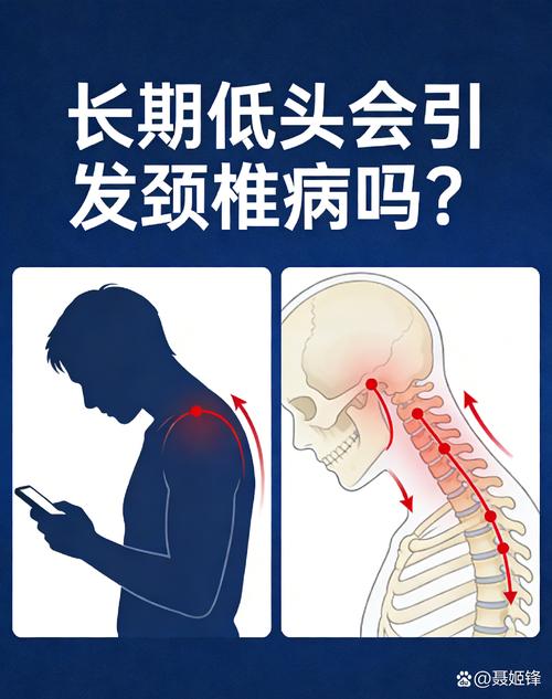 低头书写导致颈椎压力示意图