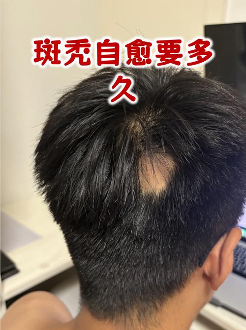 三个让你头秃的坑
