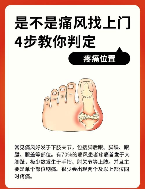 痛风患者的急性期关节制动保护:你真的做对了吗?-仁者医