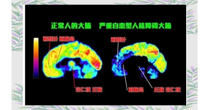 人类大脑恐惧反应与突破常规决策的神经机制对比