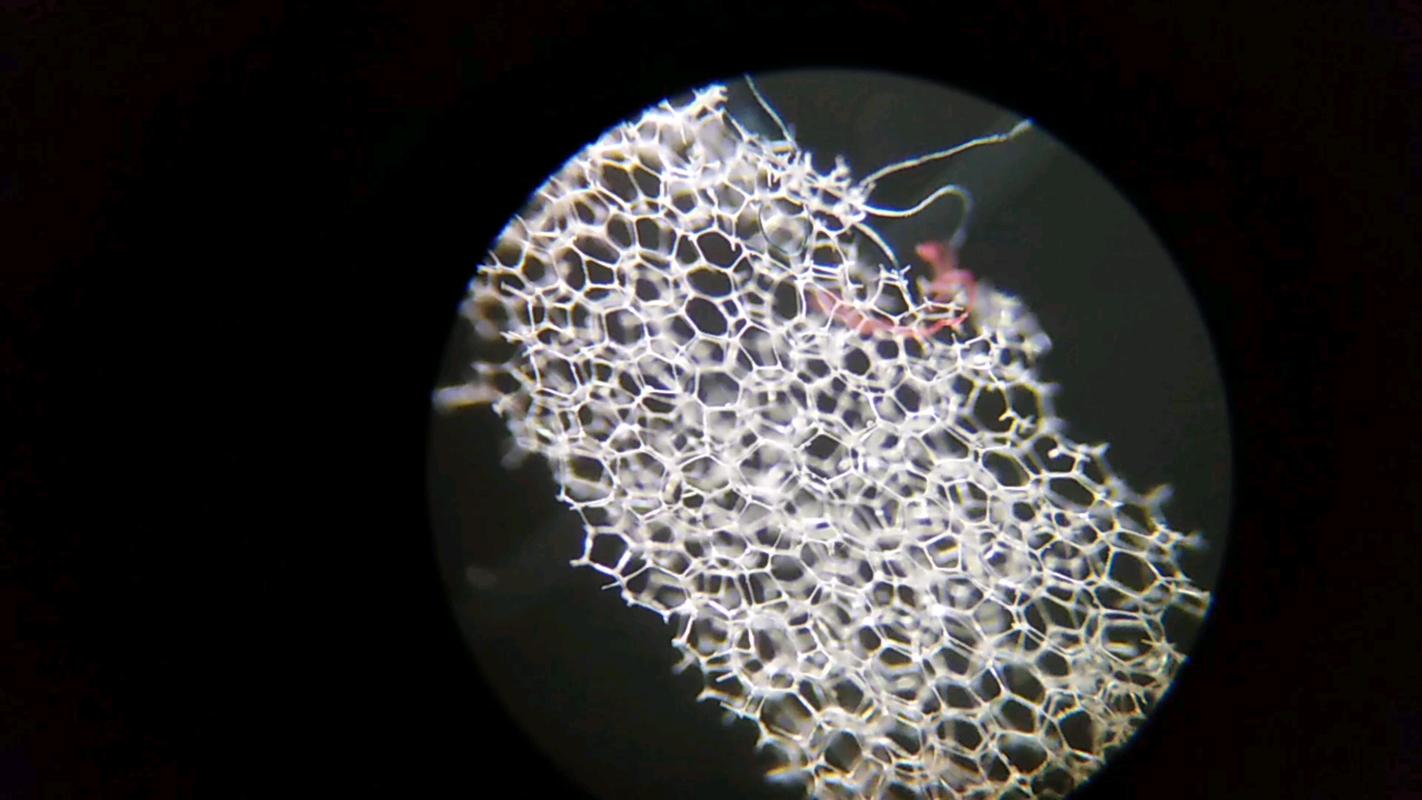 显微镜下家用洗碗海绵菌群图