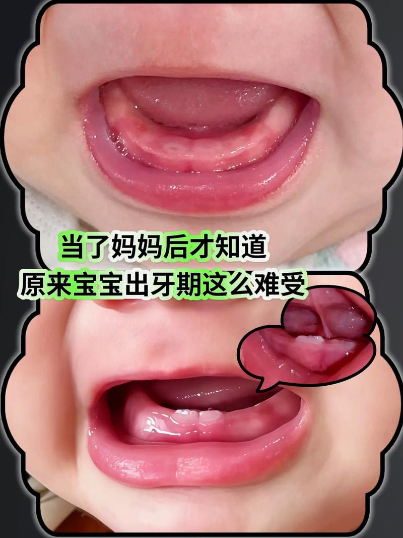 宝妈给宝宝按摩牙龈缓解出牙不适实拍