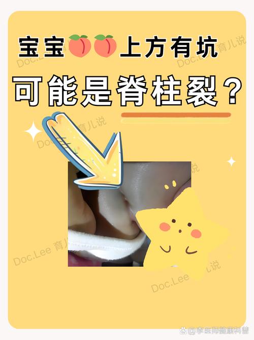 那些看不见的隐性坑