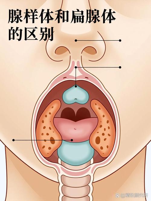 其他细节:鼻子、喉咙和静电