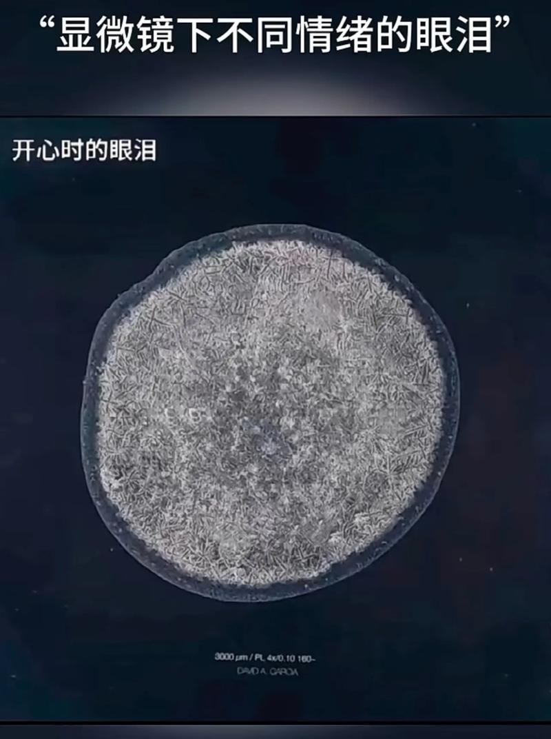 显微摄影的血泪史——零下20度的浪漫
