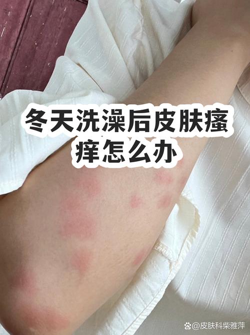 冬天洗澡，别越洗越痒