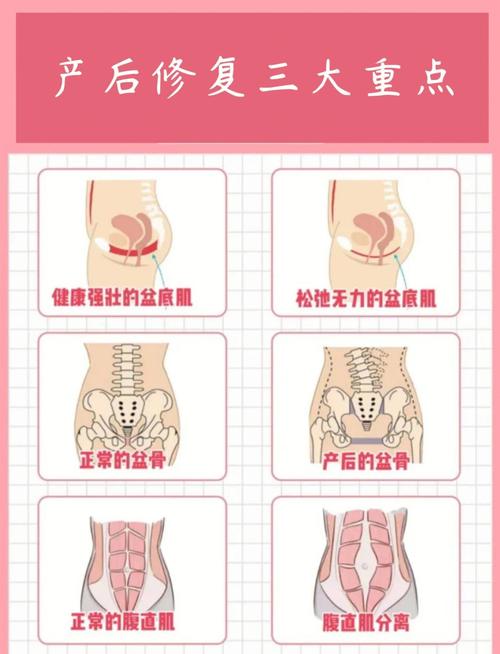 ❗ 产后恢复的三大坑，你踩过几个？