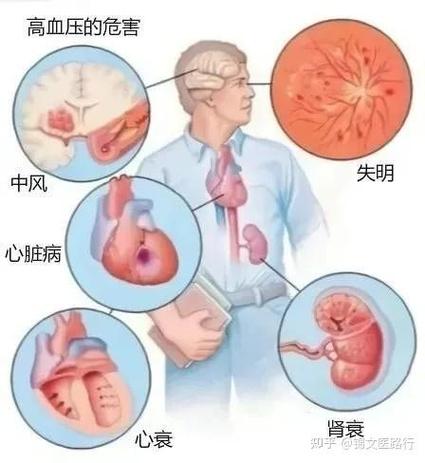 四、常见纠纷,血压飙升的现实案例