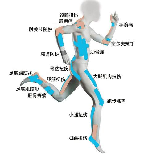 徒步重点防护身体部位示意图