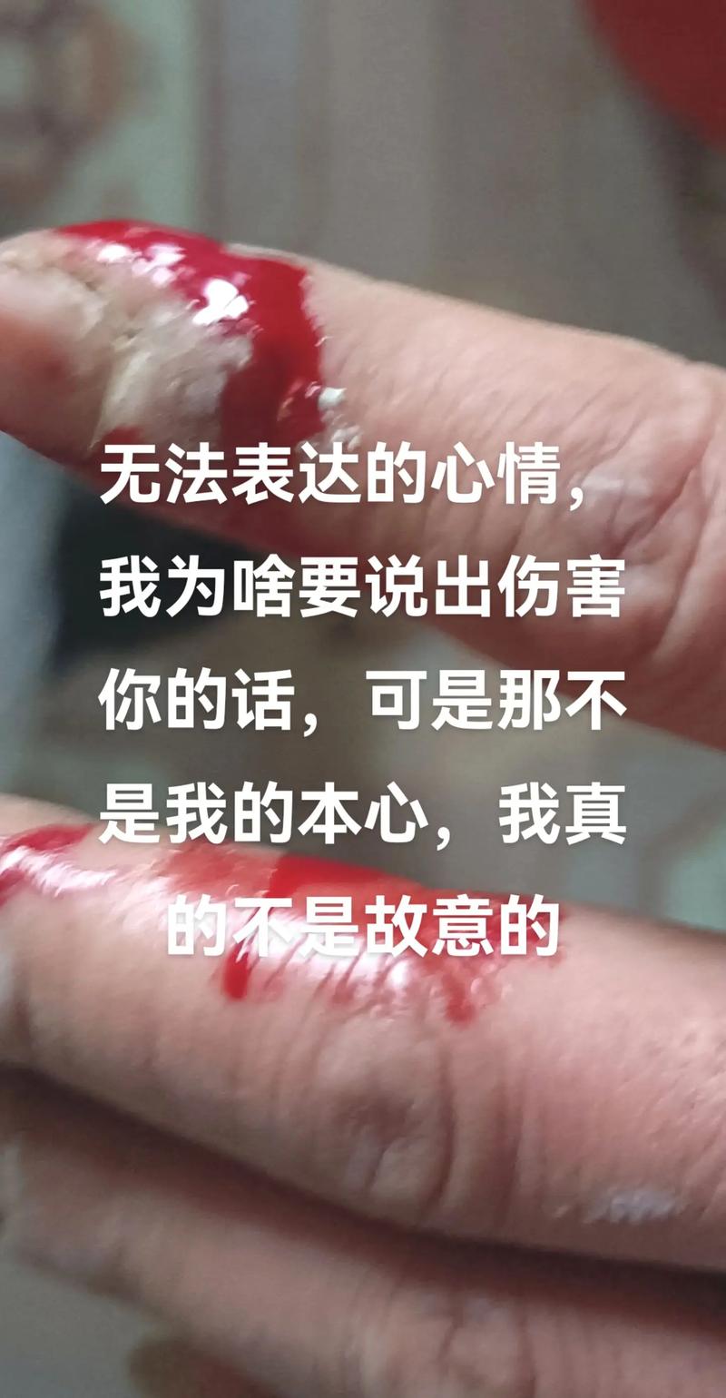 3. 突然咬人:我不是真的想伤害你,只是玩high了