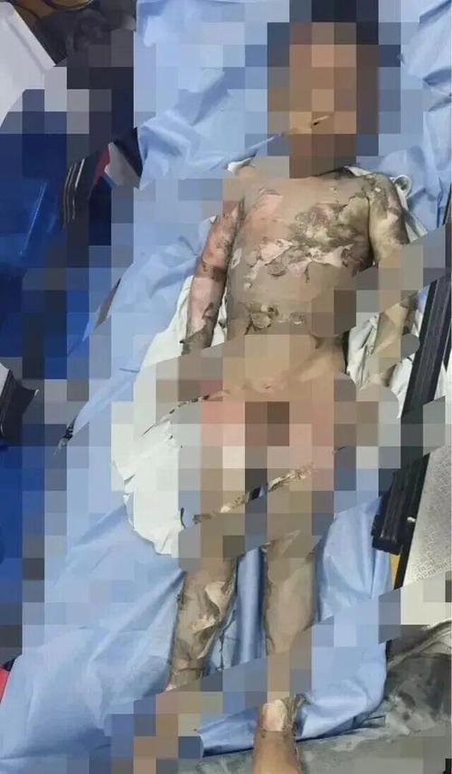 现场惨案：每平方厘米烧掉几块钱
