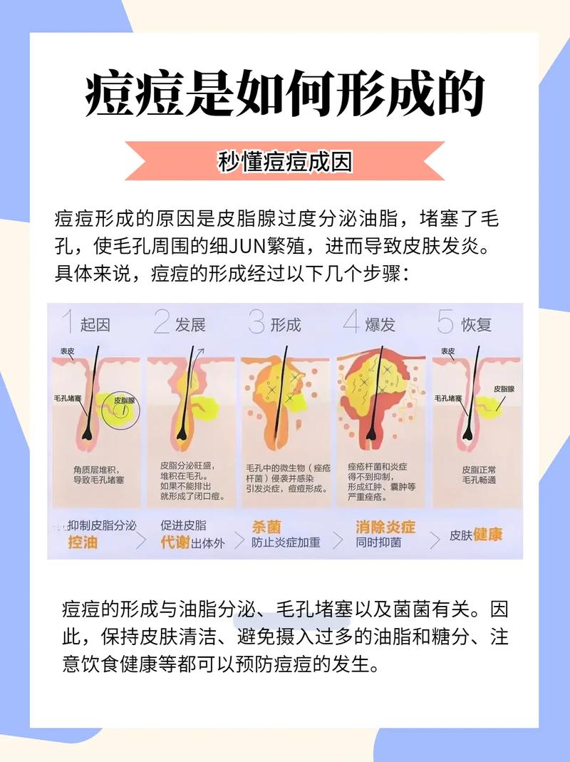 痤疮患者的低糖低脂饮食影响:适合普通人的实用科普-仁者医