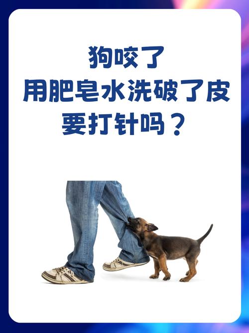 动物咬伤：肥皂水冲洗，别犹豫，去打狂犬疫苗