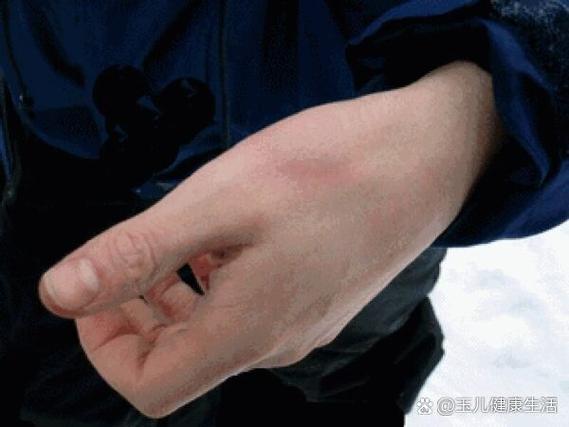 签协议的手，为什么抖