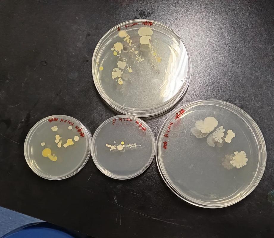 生物科技实验室培养微生物菌落实拍