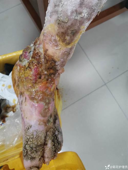 烧烤网粘肉 失败现场