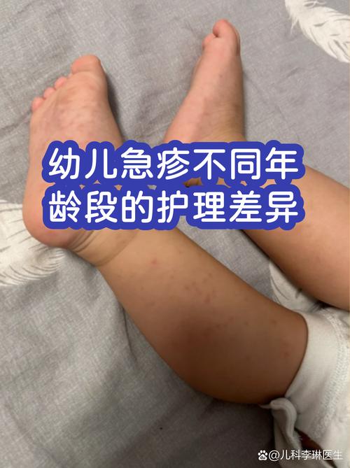 不能拖的宝宝站立就医红线