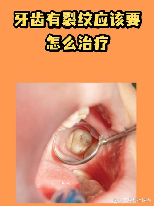 已经出了微裂纹怎么救？别直接扔
