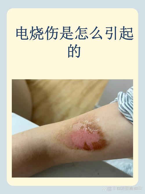 电火花加工工件积碳烧伤缺陷实拍