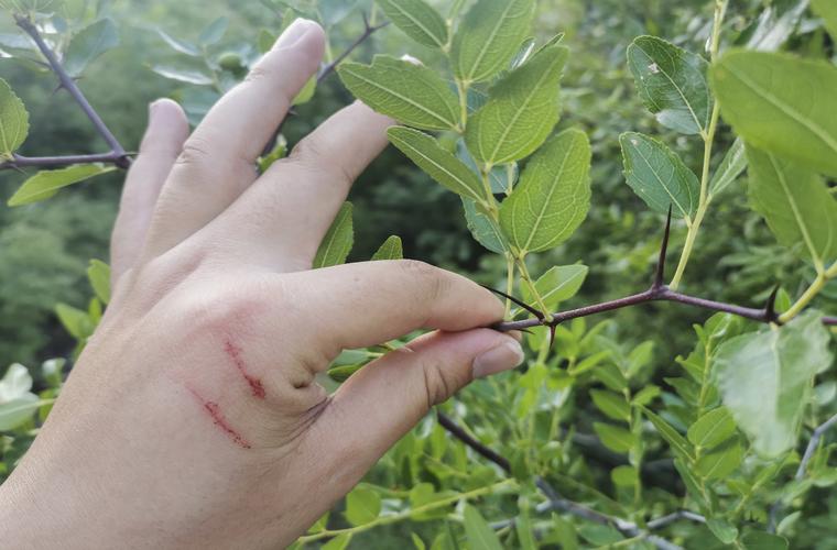 园艺师双手荆棘划痕特写