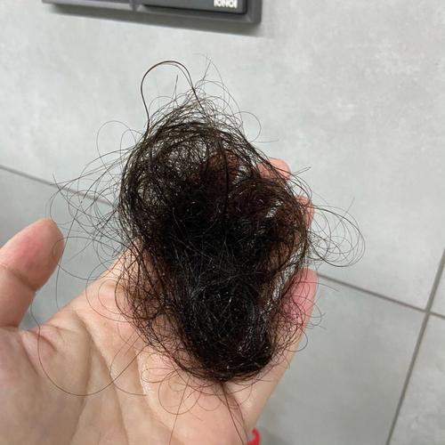 产后脱发的第一个坑：累出来的？补觉就能好？