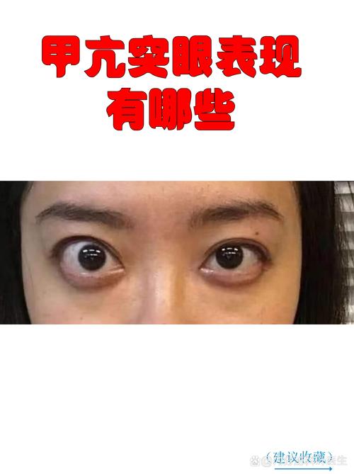 👀 眼睛比舌头更着急