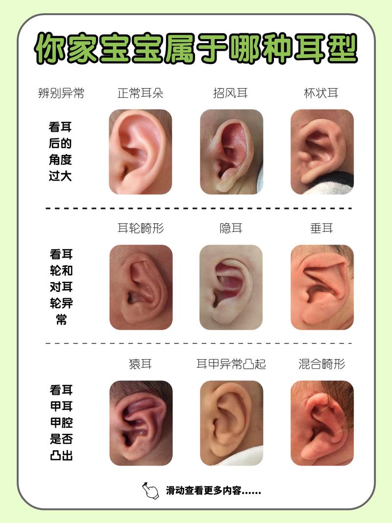 儿童耳朵遗传特征记录表,特写耳垂分离与附着对比