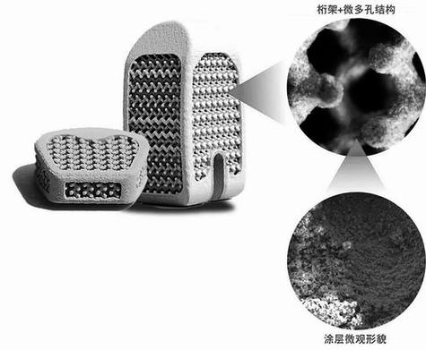 临床用个性化3D打印多孔钛脊柱融合器