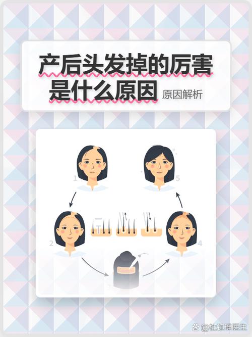 产后脱发与雌激素水平变化对应曲线图