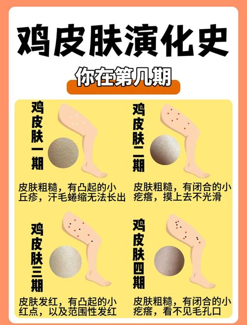 那些让人起鸡皮疙瘩的雷区,踩一个就完蛋