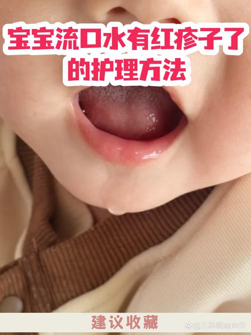 宝宝出牙期口水疹护理示意图