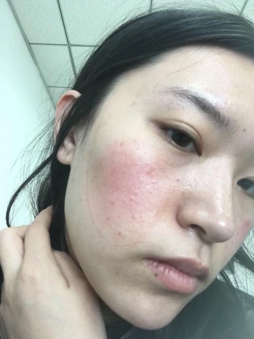最后说点带血丝的实话