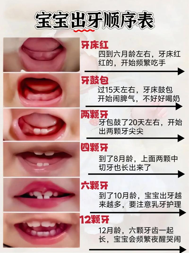 婴儿乳牙萌出顺序图，标注典型时间范围