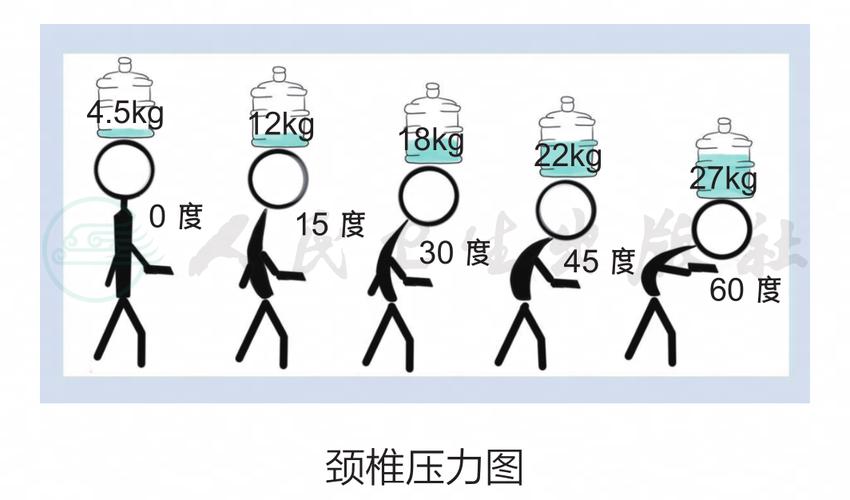不同低头角度颈椎受力示意图