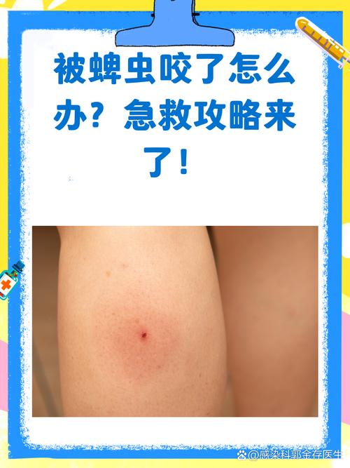 被咬了之后,怎么办?