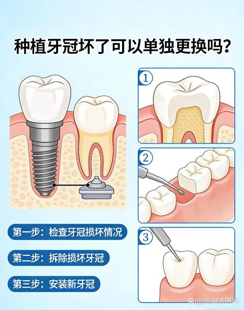 拆装就怕这几个错，换完三个月又坏
