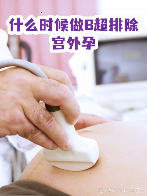 自己在家就能做的初步排查