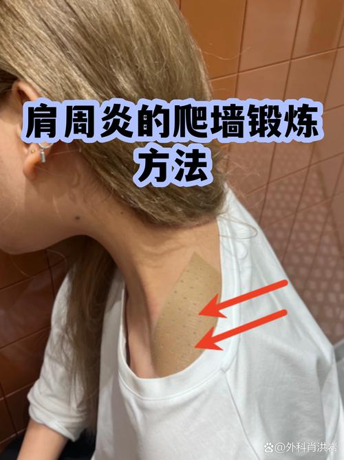 一步步拆解，肩周炎爬墙锻炼正确动作