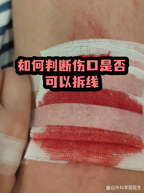 不用拆，自己就能初步判断