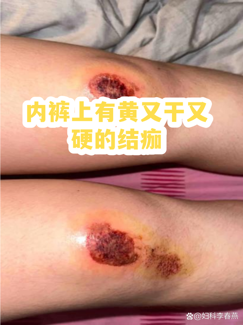 别等黄垢结硬了再刷,累的全是自己