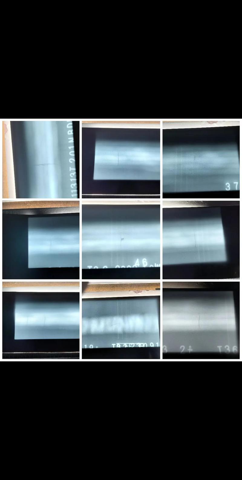射线检测底片裂纹缺陷对比图