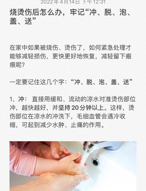 烫伤后剪开衣物 避免撕扯 剪刀处理