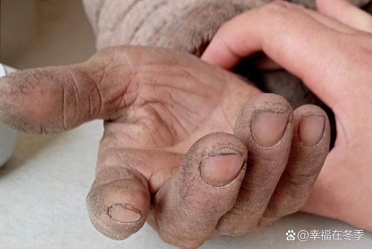 碛口老纤夫手掌上的厚老茧