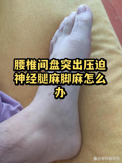 上班族腰突在家卧床对着房贷计算器发愁的实拍