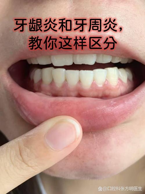 牙龈出血的牙刷选择与刷牙手法：普通人一看就会的实用技巧-仁者医