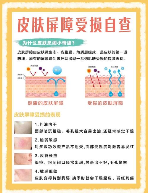儿童湿疹受损皮肤屏障示意图