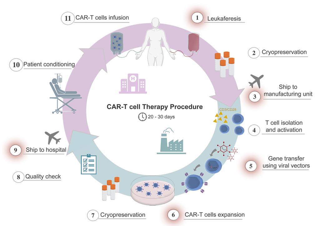 嵌合抗原受体T细胞(CAR-T)治疗流程图