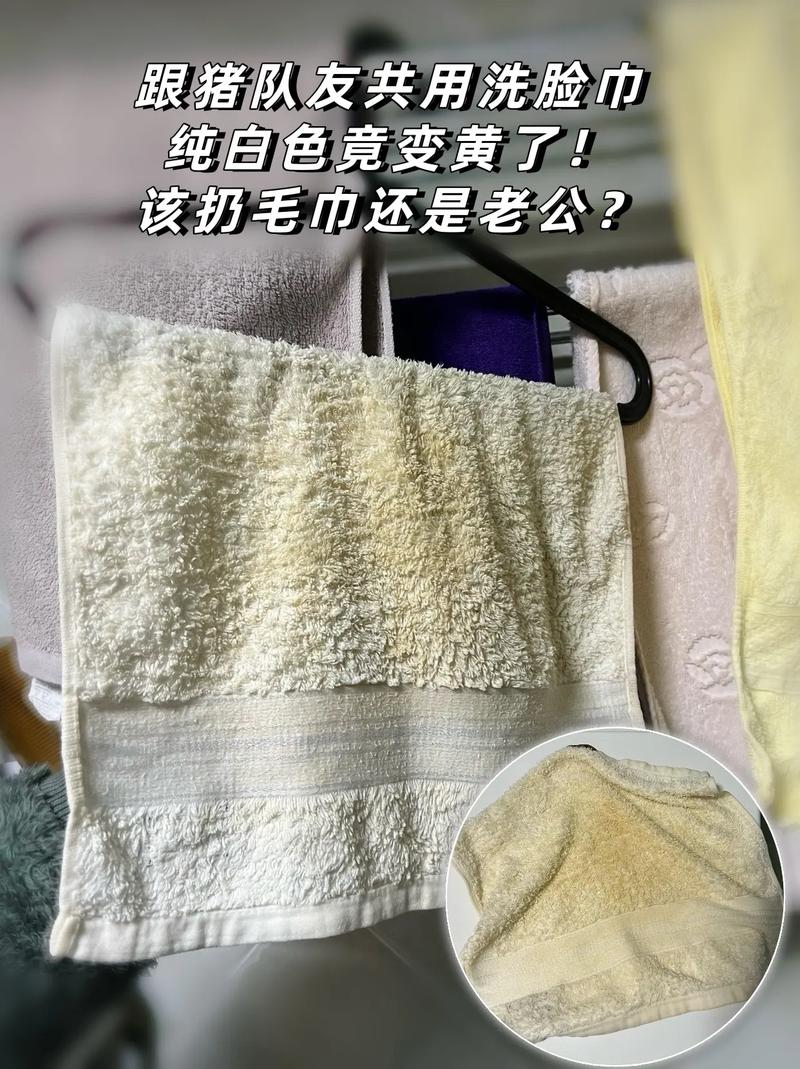浴室毛巾架上发硬发黄的旧毛巾特写